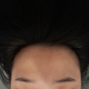 광교탈모 두피관리 도노포레스타광교신도시점 솔직 후기