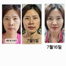 금강부분정비 이미지