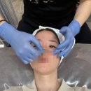 6562 | 수안동 &#39;마리뷰티&#39; 에어플라즈마로 문제성 피부 관리받은 후기