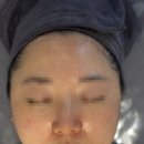 드림세탁소 | 에스테틱] 물놀이 후 뒤집어진 홍조여드름 가라앉힌 문제성피부관리 솔직후기 '올가드림뷰티 명륜자이점'