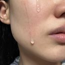 동아제약(주) | 멜라논크림 동아제약 가격 및 관리 후기