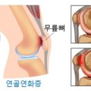 연화케어 이미지