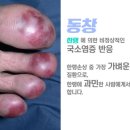 동창 이미지