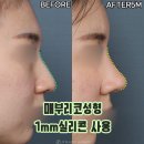 제이티성형외과의원 이미지