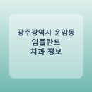 미주치과병원 | 광주광역시 운암동 임플란트 병원 찾는다면, 가격표와 후기 먼저 보기