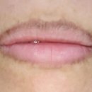 아우름의원 이미지