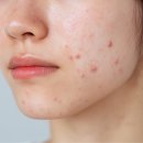 서울에이치피부과의원 이미지