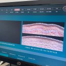 강남센트럴약국 | 내돈내산 스마일라식 프로 수술 후기 (강남 ㅈㅇㅅ안과 | ㅇㅅㅇ 원장님) +지인할인 코드 | 일반 스마일...