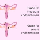 내강한의원 이미지
