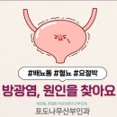 태전포도나무