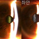 단안