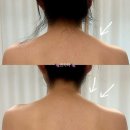 금천구체형관리 올바른미테라피 100% 수기 에너지테라피로 어깨라인 비대칭교정 찐 후기