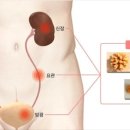 정한수비뇨기과 이미지