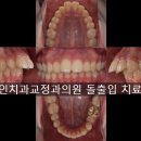 앵글치과의원 티스토리
