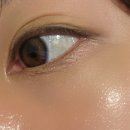 대치더블유피부과의원 | 대치역 피부과 &lt;멘토의원&gt; 아이라인 반영구 제거 후기!