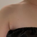 [공지] 닥터손유나의원 팔뚝 매직캣주사 2회차 솔직후기 (복합지방파괴레이저 다이어트주사)