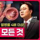 재발률 최대 70%? 치료 후에도 안심할 수 없는 방광암ㅣ메디컬 인사이트 [106회] 이미지