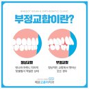 배곧고운이치과의원 | 배곧신도시앞니부분교정 받을수 있는곳 배곧고운이치과의원