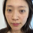 뷰티온의원 광주첨단 네이버블로그