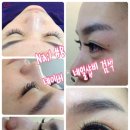 Nail #B