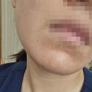 달리는커피덕천이즈카운티점 | 덕천 전문 피부관리는 이곳, 진뷰티랩