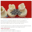 앞선치과기공소 이미지
