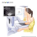 [세이유외과의원 군자점] 유방암 검사 &gt; 혹발견 &gt; 조직검사 후기까지..!