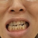 이대역4번출구 이미지