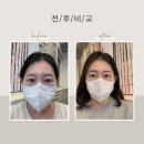 유즈브로우 | 노원 눈썹문신 유즈브로우 완전 추천 내돈내산 후기