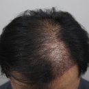 모나라피부과의원 이미지