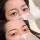 보람아바드 | 눈썹의 붉거나 푸른 잔흔 방지법과 관리 팁 TIP │홍대 망원 합정 마포 구청 아바드뷰티스튜디오