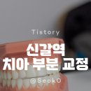 푸른치과의원 | 신갈역 치과 추천 – 미푸른치과 부분 교정 솔직 후기