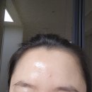 6월올영세일 추천템 : 하루 5분! 듀얼소닉 하이푸 솔직 사용후기