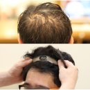 천호코오롱상가 | 잠실 가발 대여 선택폭이 넓어요