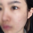 굿셀케어 | UNISE 셀 크림 비타민크림 악건성때문에 보습각질케어에 좋은 부드러운 크림