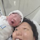 마이비산후조리원 | 논현 마이비산부인과에서 제왕절개후기! 마이비 산후조리원 추천드려요 가성비조리원