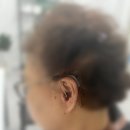 하단독일보청기 이미지