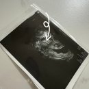 11500-9-78-06 | [공지] 난임일기_06 | 광주 소노아 여성의원 | 인공수정 당일 | 인공수정 후기 | 인공수정 2차 | 인공...