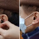 포낙보청기 동작센터 네이버블로그