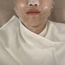 대구 여드름관리 맛집, 수성구 피부관리 잘하는 곳 알로하에스테틱