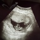 양산보람산부인과의원 | [임신 14주] 추추의 성별 확인! 울산 루나산부인과 서브병원 방문 후기