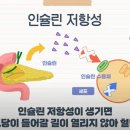 [명의를 찾아서] “빈부가 건강 격차를 만드는 시대, 비만형 당뇨 대비해야” 이미지