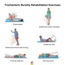 Trochanteric Bursitis Rehabilitation Exercises 이미지