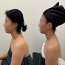 에스테틱다리아 분당정자점 승모근 어깨. 허리통증 등신경테라피 집중관리 후기