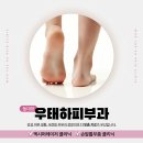 우태하피부과의원 동대문점 | 동대문발톱무좀, 이 정도면 괜찮겠지 했다가 길어지는 경우 많습니다