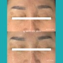 코스킨 | 군포 산본 눈가주름 코주름 개선, 리턴스킨 에어쎈 주름관리 후기