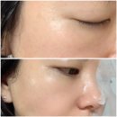 (주)닥터솔루션 | 기미 잡티 제거 마스크팩 닥터오기덤 앰플샷 화이트닝 일주일 사용 후기