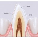 앞니라미네이트가격 20만원 vs 100만원 왜 차이날까? 나에게 맞는 선택법