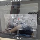 우리들40플란트치과병원 | 과잉치 발치 1년 뒤 : <대학병원 소아치과> 첫 진료 기록