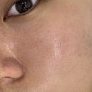 위드미 포항양학점 | 포항피부관리 제대로 받고 온 효자동 벨루위드미